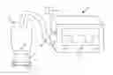 Fig. 01 - Method for enhancing postoperative healing using low pressure suction apparatus