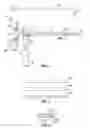 Fig. 02 - IMAGE-GUIDED IRRIGATING SUCTION CANNULA FOR REMOVAL OF INTRACEREBRAL HEMORRHAGE AND OTHER LESIONS
