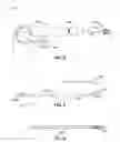 Fig. 03 - IMAGE-GUIDED IRRIGATING SUCTION CANNULA FOR REMOVAL OF INTRACEREBRAL HEMORRHAGE AND OTHER LESIONS