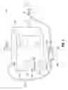Fig. 02 - MOTORIZED CHEST DRAINAGE SYSTEM