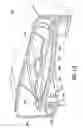 Fig. 10 - Patch-like infusion device