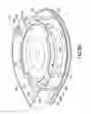 Fig. 28 - Patch-like infusion device