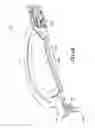 Fig. 44 - Patch-like infusion device
