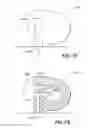 Fig. 66 - Patch-like infusion device