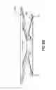 Fig. 74 - Patch-like infusion device