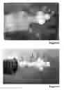 Fig. 03 - ADAPTER, PROCESS AND USE FOR INSTILLATION OF AGENTS INTO THE BLADDER THROUGH THE URETHRA WITHOUT CATHETER