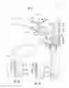 Fig. 04 - Internally pressurized medical devices