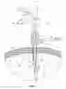 Fig. 05 - Internally pressurized medical devices
