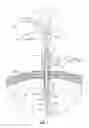 Fig. 07 - Internally pressurized medical devices