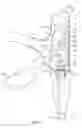 Fig. 12 - Internally pressurized medical devices