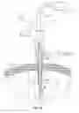 Fig. 13 - Internally pressurized medical devices