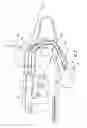 Fig. 03 - SUBGLOTTIC ASPIRATION DEVICE