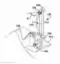 Fig. 01 - SYSTEM AND METHOD FOR SECURING A BREATHING GAS DELIVERY HOSE