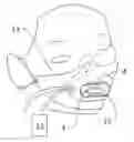 Fig. 01 - TRANSORAL PROCEDURE MASK