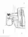 Fig. 17 - Flow mixers for respiratory therapy systems