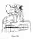 Fig. 26 - Flow mixers for respiratory therapy systems