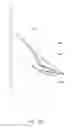 Fig. 41 - Medical device insertion apparatus, system and method