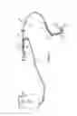 Fig. 02 - Systems and methods for controlling reperfusion in a vessel