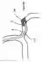 Fig. 15 - Systems and methods for controlling reperfusion in a vessel