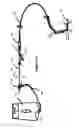 Fig. 17 - Systems and methods for controlling reperfusion in a vessel