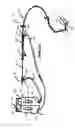 Fig. 19 - Systems and methods for controlling reperfusion in a vessel