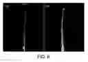 Fig. 07 - Devices and methods for alleviating lymphatic system congestion