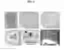Fig. 03 - Compositions and delivery methods for treating dental infections, inflammation, sensitivity, and for use in dental restorations