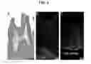 Fig. 05 - Compositions and delivery methods for treating dental infections, inflammation, sensitivity, and for use in dental restorations