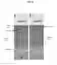 Fig. 09 - Compositions and delivery methods for treating dental infections, inflammation, sensitivity, and for use in dental restorations