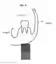 Fig. 10 - Compositions and delivery methods for treating dental infections, inflammation, sensitivity, and for use in dental restorations
