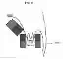Fig. 11 - Compositions and delivery methods for treating dental infections, inflammation, sensitivity, and for use in dental restorations