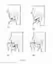 Fig. 06 - A TONGUE TREATMENT ELECTRODE AND A DEVICE USING THE SAME