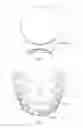 Fig. 02 - Tooth-whitening device