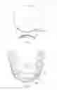 Fig. 02 - Tooth-whitening process