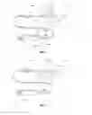 Fig. 02 - Intracavity balloon catheter