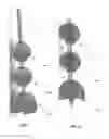 Fig. 04 - Intracavity balloon catheter