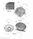 Fig. 05 - Intracavity balloon catheter