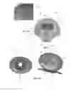 Fig. 06 - Intracavity balloon catheter