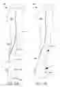 Fig. 10 - Apparel item with integrated parachute structure