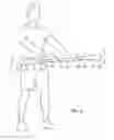 Fig. 03 - Sensorimotor device for exercise and rehabilitation