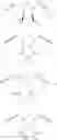 Fig. 05 - Hydrophilically modified fluorinated membrane (I)