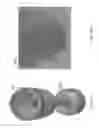Fig. 20 - Devices and methods for overlaying blood or cellular suspensions