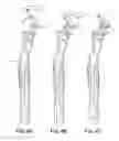 Fig. 05 - Wet-shave razor guard