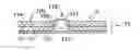 Fig. 01 - Item comprising a mounting and a decorative design element embedded in the mounting and visible