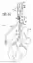 Fig. 13 - Cable trolley having evacuation aid