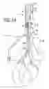 Fig. 14 - Cable trolley having evacuation aid