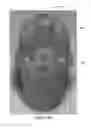 Fig. 10 - Beverage lid cover for enhancing aroma