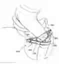 Fig. 01 - Horseman-securing device, saddle, and saddle securing device for preventing a horseman from falling off a four-legged animal