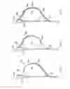 Fig. 05 - Horseman-securing device, saddle, and saddle securing device for preventing a horseman from falling off a four-legged animal