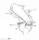 Fig. 09 - Horseman-securing device, saddle, and saddle securing device for preventing a horseman from falling off a four-legged animal